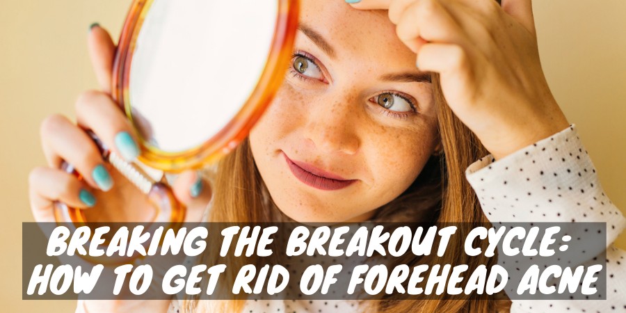Girl tries to get rid of forehead acne